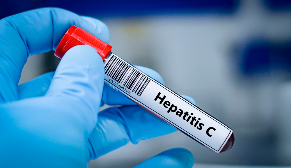 Día Mundial contra la Hepatitis: la importancia de la prevención, la vacunación y el diagnóstico oportuno