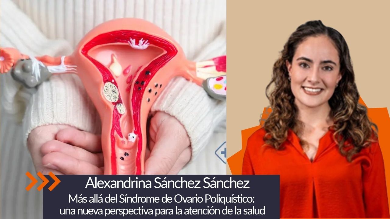 Más allá del Síndrome de Ovario Poliquístico: una nueva perspectiva para la atención de la salud