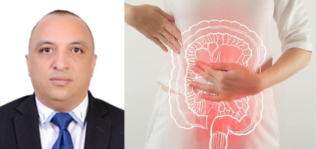 Cáncer de Colon ¿Un asesino silencioso?