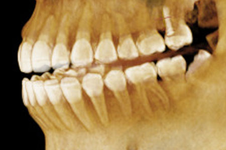 Tomografías CONE BEAM