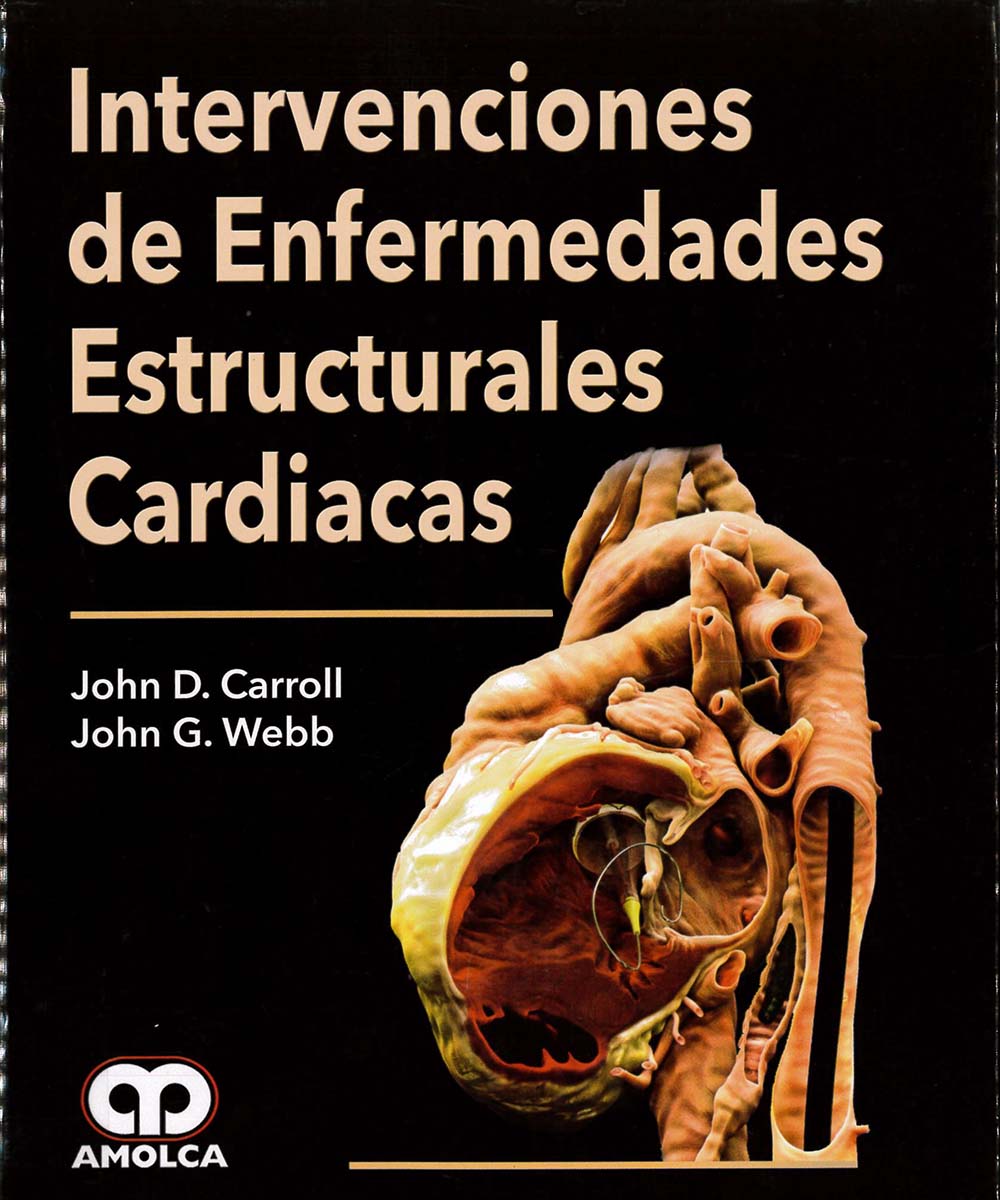 13 / 13 - RD598 I-58 INTERVENCIONES DE ENFERMEDADES ESTRUCTURARES CARDIACAS, JOHN D. CARROLL -