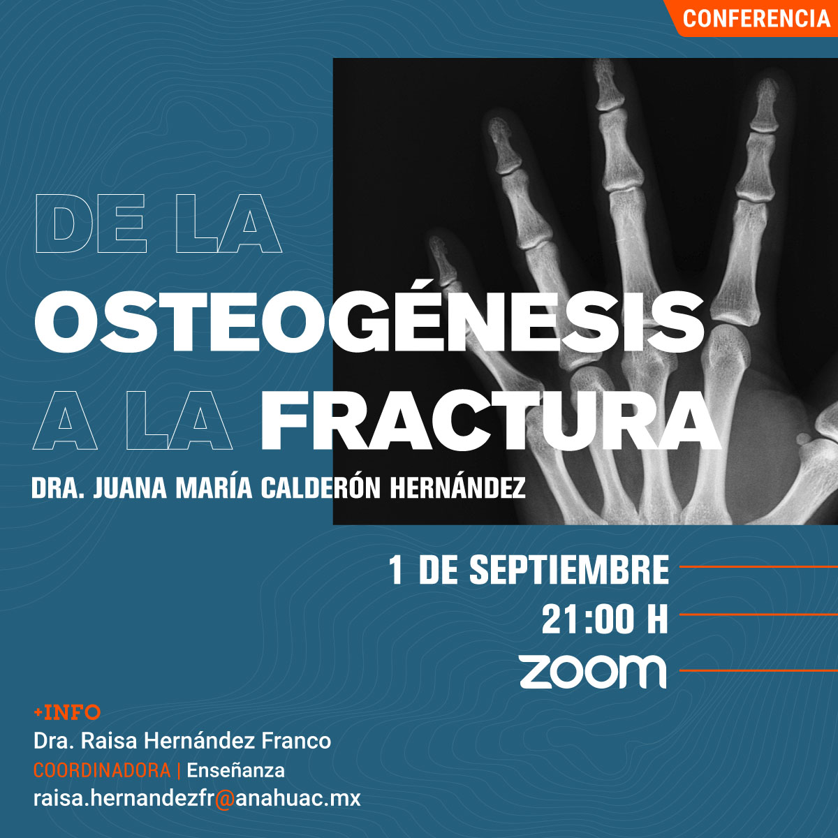 De la Osteogénesis a la Fractura De la Osteogénesis a la Fractura